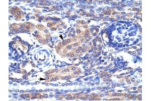 KCNAB3 antibody was used for immunohistochemistry at a concentration of 4-8 ug/ml to stain Epithelial cells of renal tubule (arrows) in Human Kidney. (KCNAB3 antibody  (N-Term))