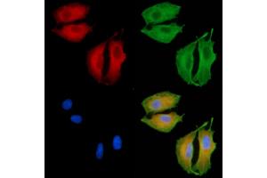 ABIN6260504 and ABIN6279263 staining  cells by IF/ICC.