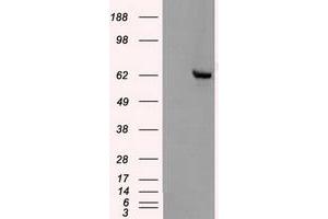 Image no. 5 for anti-Checkpoint Kinase 2 (CHEK2) antibody (ABIN1497498) (CHEK2 antibody)