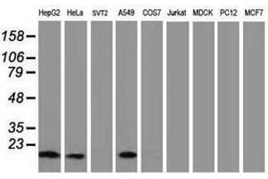 Image no. 6 for anti-Destrin (Actin Depolymerizing Factor) (DSTN) antibody (ABIN1497910) (Destrin antibody)