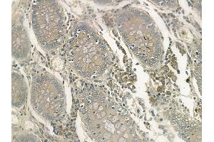 ABIN6263060 and ABIN6272509 at 1/100 staining human normal colon tissue by IHC-P. (MAGEA11 antibody  (C-Term))