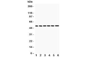 Western blot testing of p50 antibody and 1:  rat spleen;  2: (r) PC-12; and human samples 3: HeLa;  4: A431;  5: Jurkat;  6: MCF-7;  Predicted/observed size: 50/105KD depending on sample (CD40 antibody  (AA 1-360))