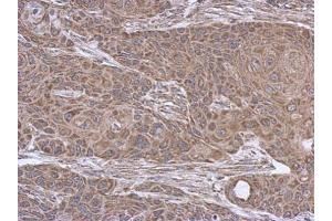 IHC-P Image Immunohistochemical analysis of paraffin-embedded Cal27 xenograft, using SUCLA2, antibody at 1:500 dilution.