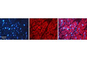 Rabbit Anti-PPIB Antibody   Formalin Fixed Paraffin Embedded Tissue: Human heart Tissue Observed Staining: Cytoplasmic Primary Antibody Concentration: N/A Other Working Concentrations: 1:600 Secondary Antibody: Donkey anti-Rabbit-Cy3 Secondary Antibody Concentration: 1:200 Magnification: 20X Exposure Time: 0. (PPIB antibody  (N-Term))