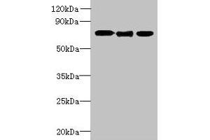 Western blot All lanes: SLC23A1 antibody at 3 μg/mL Lane 1: A549 whole cell lysate Lane 2: Mouse liver tissue Lane 3: Mouse kidney tissue Secondary Goat polyclonal to rabbit IgG at 1/10000 dilution Predicted band size: 65, 66, 29 kDa Observed band size: 65 kDa (SLC23A1 antibody  (AA 173-259))