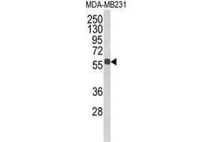 Western blot analysis of ALDH3B1 Antibody (Center) in MDA-MB231 cell line lysates (35ug/lane). (ALDH3B1 antibody  (Middle Region))