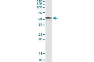Immunoprecipitation of GIF transfected lysate using anti-GIF monoclonal antibody and Protein A Magnetic Bead , and immunoblotted with GIF MaxPab rabbit polyclonal antibody. (Intrinsic Factor antibody  (AA 318-417))