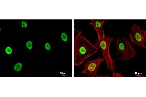 ICC/IF Image SAE1 antibody detects SAE1 protein at nucleus by immunofluorescent analysis. (SAE1 antibody)