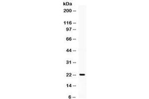 Western blot testing of human K562 cell lysate with G-CSF antibody. (G-CSF antibody  (AA 38-207))