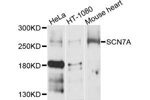 Western blot analysis of extracts of various cells, using SCN7A antibody. (SCN7A antibody)