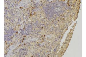 ABIN6272244 at 1/100 staining Human lymph node tissue by IHC-P. (ARHGAP1 antibody  (Internal Region))