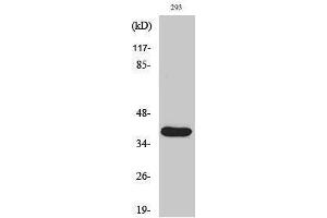 Western Blotting (WB) image for anti-Matrix Metallopeptidase 23 (MMP23) (cleaved), (Tyr79) antibody (ABIN3181816) (Matrix Metallopeptidase 23 (MMP23) (cleaved), (Tyr79) antibody)