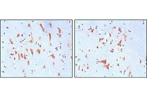 Immunohistochemical analysis of paraffin-embedded human brain tissues, showing cytoplasmic localization with DAB staining using FMR1 mouse mAb. (FMR1 antibody)