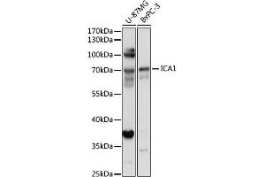 Western blot analysis of extracts of various cell lines, using IC antibody (7500) at 1:1000 dilution. (ICA1 antibody  (AA 1-160))