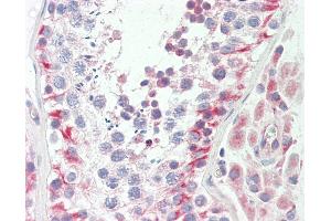 anti-Ubiquinol-Cytochrome C Reductase Core Protein II (UQCRC2) (AA 235-264) antibody