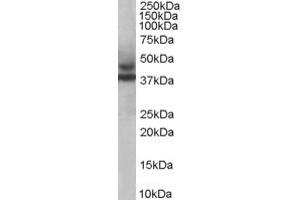 TRIM54 antibody  (C-Term)
