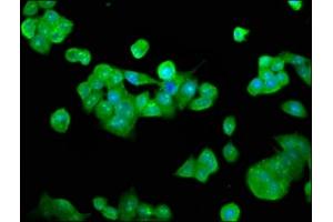 Immunofluorescence staining of PC-3 cells with ABIN7150389 at 1:133, counter-stained with DAPI. (RFXANK antibody  (AA 3-84))