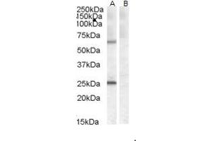 (ABIN238598) (0. (COL4A3BP antibody  (AA 662-672))