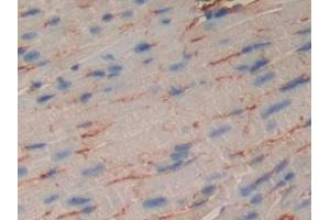Immunohistochemistry (IHC) image for anti-Muscle, Skeletal, Receptor Tyrosine Kinase (MUSK) (AA 517-777) antibody (ABIN7435772)