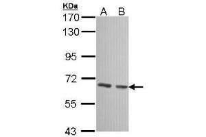 WB Image Sample (30 ug of whole cell lysate) A: 293T B: A431 , 7. (GCKR antibody)