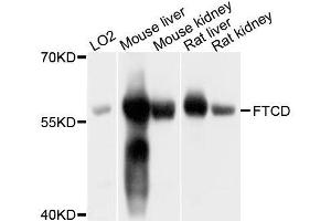 Western blot analysis of extracts of various cell lines, using FTCD antibody (ABIN5996118) at 1/1000 dilution. (FTCD antibody)