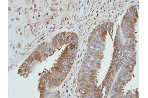 IHC-P Image Immunohistochemical analysis of paraffin-embedded UGP2 xenograft, using UGP2, antibody at 1:100 dilution. (UGP2 antibody)