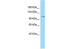 Host: Rabbit Target Name: SLFN5 Sample Type: Fetal Heart lysates Antibody Dilution: 1. (SLFN5 antibody  (N-Term))