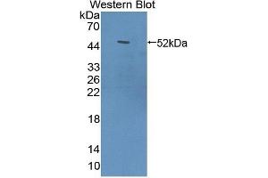 Detection of Recombinant ACOX1, Human using Polyclonal Antibody to Acyl Coenzyme A Oxidase 1, Palmitoyl (ACOX1) (ACOX1 antibody  (AA 210-409))