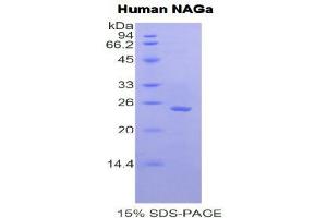 SDS-PAGE (SDS) image for N-Acetylgalactosaminidase, alpha (NAGA) (AA 218-411) protein (His tag) (ABIN1877817) (NAGA Protein (AA 218-411) (His tag))
