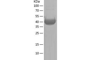 Western Blotting (WB) image for B-Raf proto-oncogene, serine/threonine kinase (BRAF) (AA 8-170) protein (His-IF2DI Tag) (ABIN7121967) (BRAF Protein (AA 8-170) (His-IF2DI Tag))