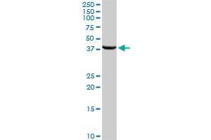 HSD17B2 MaxPab rabbit polyclonal antibody. (HSD17B2 antibody  (AA 1-387))