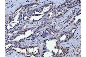 IHC analysis of KAP1 using anti-KAP1 antibody (ABIN3043491). (KAP1 antibody  (AA 699-835))