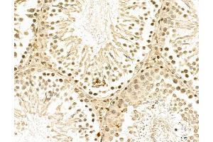 ABIN7094335 and ABIN7098382 at 1/100 staining Rat testis tissue by IHC-P. (LAS1L antibody  (C-Term))