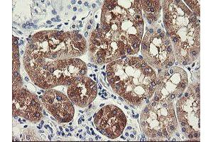 Immunohistochemistry (IHC) image for anti-Formiminotransferase Cyclodeaminase (FTCD) antibody (ABIN1496378) (FTCD antibody)