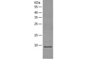Western Blotting (WB) image for High Mobility Group Nucleosomal Binding Domain 3 (HMGN3) (AA 1-77) protein (His tag) (ABIN7123334) (HMGN3 Protein (AA 1-77) (His tag))