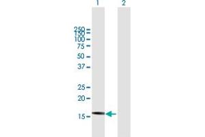 DnaJ (Hsp40) Homolog, Subfamily B, Member 3 (DNAJB3) (AA 1-145) antibody