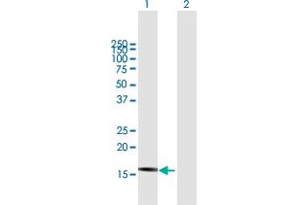 DnaJ (Hsp40) Homolog, Subfamily B, Member 3 (DNAJB3) (AA 1-145) antibody