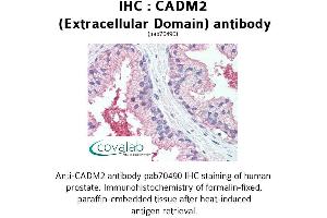 Image no. 1 for anti-Cell Adhesion Molecule 2 (CADM2) (Extracellular Domain) antibody (ABIN1732535) (CADM2 antibody  (Extracellular Domain))