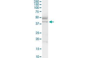 ADA MaxPab rabbit polyclonal antibody. (ADA antibody  (AA 1-363))