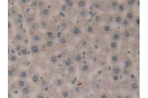 Immunohistochemistry (IHC) image for anti-Coagulation Factor XIII, A1 Polypeptide (F13A1) (AA 140-377) antibody (ABIN7440509)