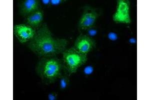 Anti-MAPK7 mouse monoclonal antibody (ABIN2454054) immunofluorescent staining of COS7 cells transiently transfected by pCMV6-ENTRY MAPK7 (RC203506). (MAPK7 antibody)