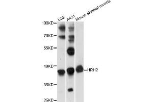 Western blot analysis of extracts of various cell lines, using HRH2 antibody (ABIN6290488) at 1:1000 dilution.