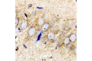 Immunohistochemistry (IHC) image for anti-Proenkephalin (PENK) antibody (ABIN7308156) (Enkephalin antibody)