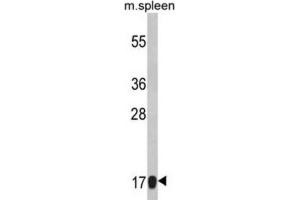 Western Blotting (WB) image for anti-Ribosomal Protein S18 (RPS18) antibody (ABIN3002859) (RPS18 antibody)