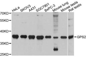 Western blot analysis of extracts of various cell lines, using GPS2 antibody. (GPS2 antibody)