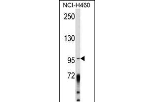 Western blot analysis of AK Antibody (Center) (ABIN652454 and ABIN2842308) in NCI- cell line lysates (35 μg/lane). (AKAP3 antibody  (AA 240-267))