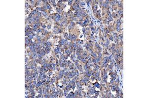IHC analysis of TTC7B using anti-TTC7B antibody (ABIN7601050). (TTC7B antibody  (AA 275-730))