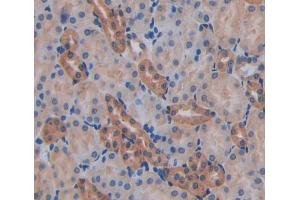 #VALUE! (AFAP antibody  (AA 352-572))