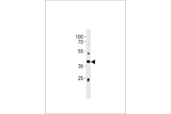 ABI3 anticorps  (C-Term)