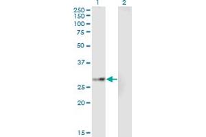 Western Blot analysis of EPHA7 expression in transfected 293T cell line by EPHA7 monoclonal antibody (M01A), clone 1G11. (EPH Receptor A7 antibody  (AA 1-279))